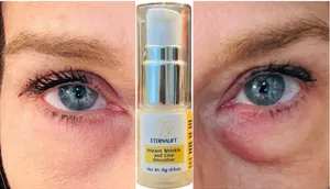 Instant Eye Bag Puffiness And Wrinkle Remover Cream For Women And Men Made In The USA! Cruelty-Free